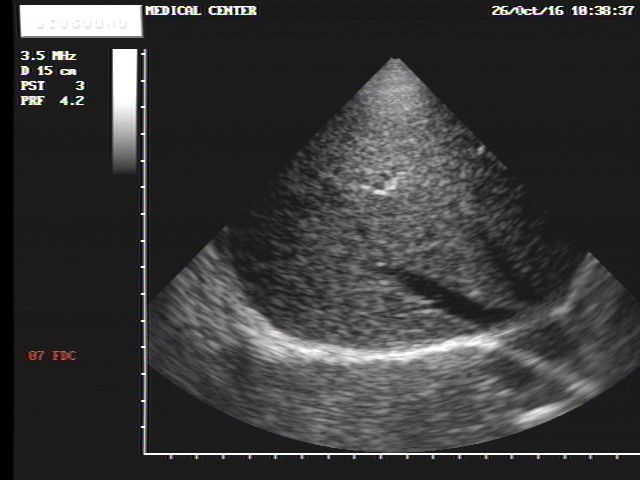 Esaote Biosound Megas/ MyLab ultrasound PA220 cardiac probe DIAGNOSTIC ULTRASOUND MACHINES FOR SALE