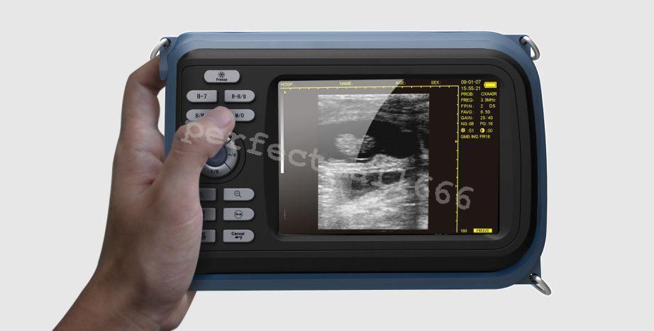 Portable Handheld Digital Ultrasound Scanner Convex Linear With 3 Probes DIAGNOSTIC ULTRASOUND MACHINES FOR SALE