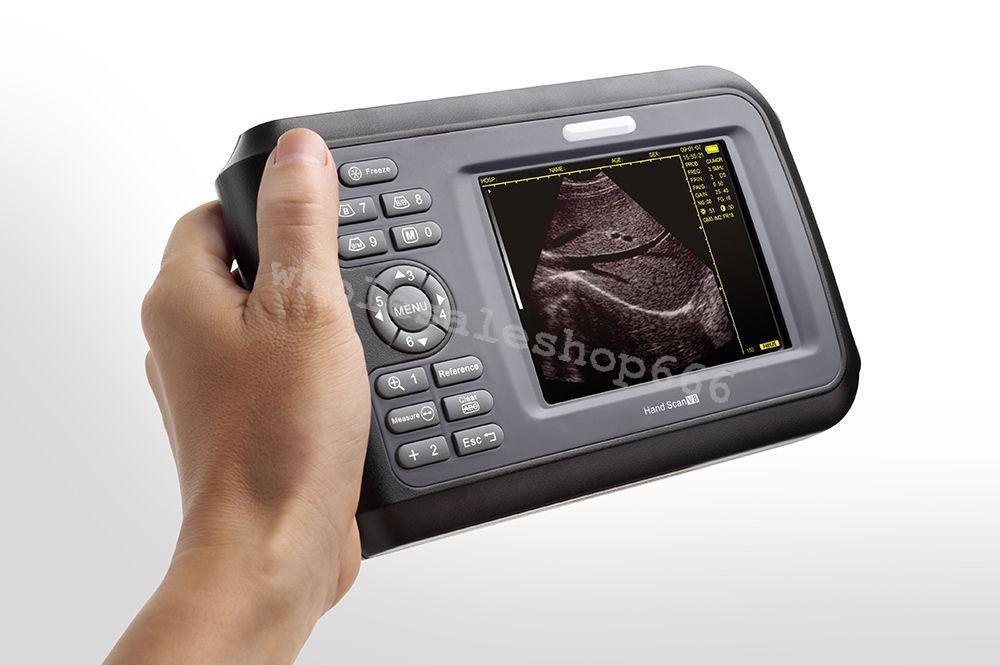 Portable Handheld Digital Ultrasound Scanner machine Cardiac Micro-convex Probe DIAGNOSTIC ULTRASOUND MACHINES FOR SALE
