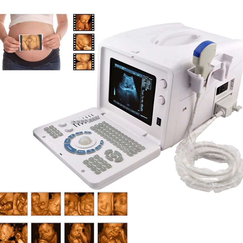 New Digital Ultrasound machine Scanner System Convex + linear Probe +3D Set pack 190891758668 DIAGNOSTIC ULTRASOUND MACHINES FOR SALE