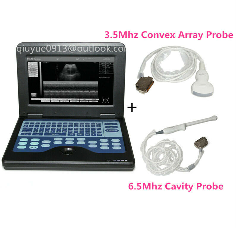 Digital Portable Ultrasound Machine Laptop Scanner with 2 Probes(Convex+Rectal) DIAGNOSTIC ULTRASOUND MACHINES FOR SALE