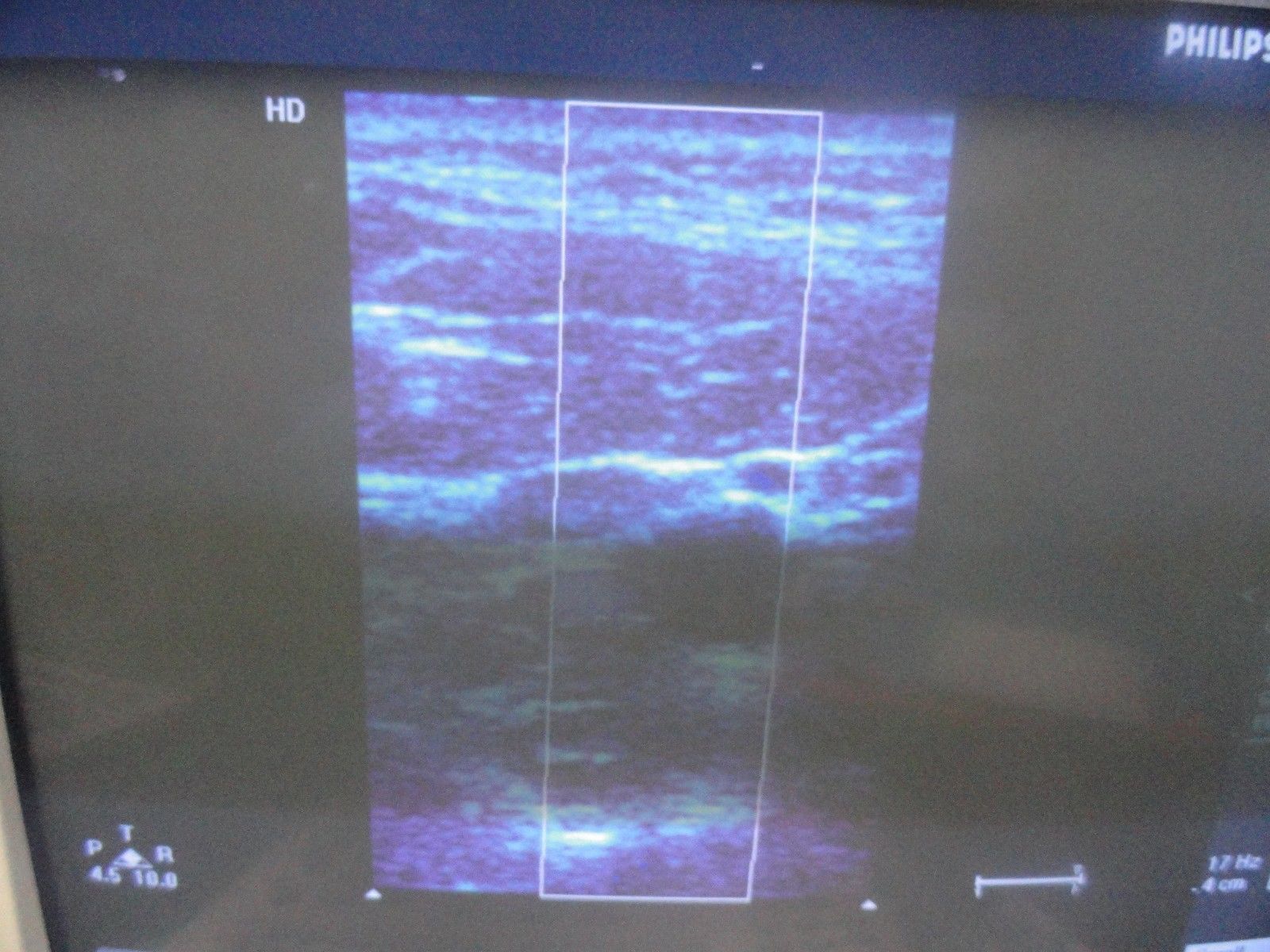 a monitor with a medical picture