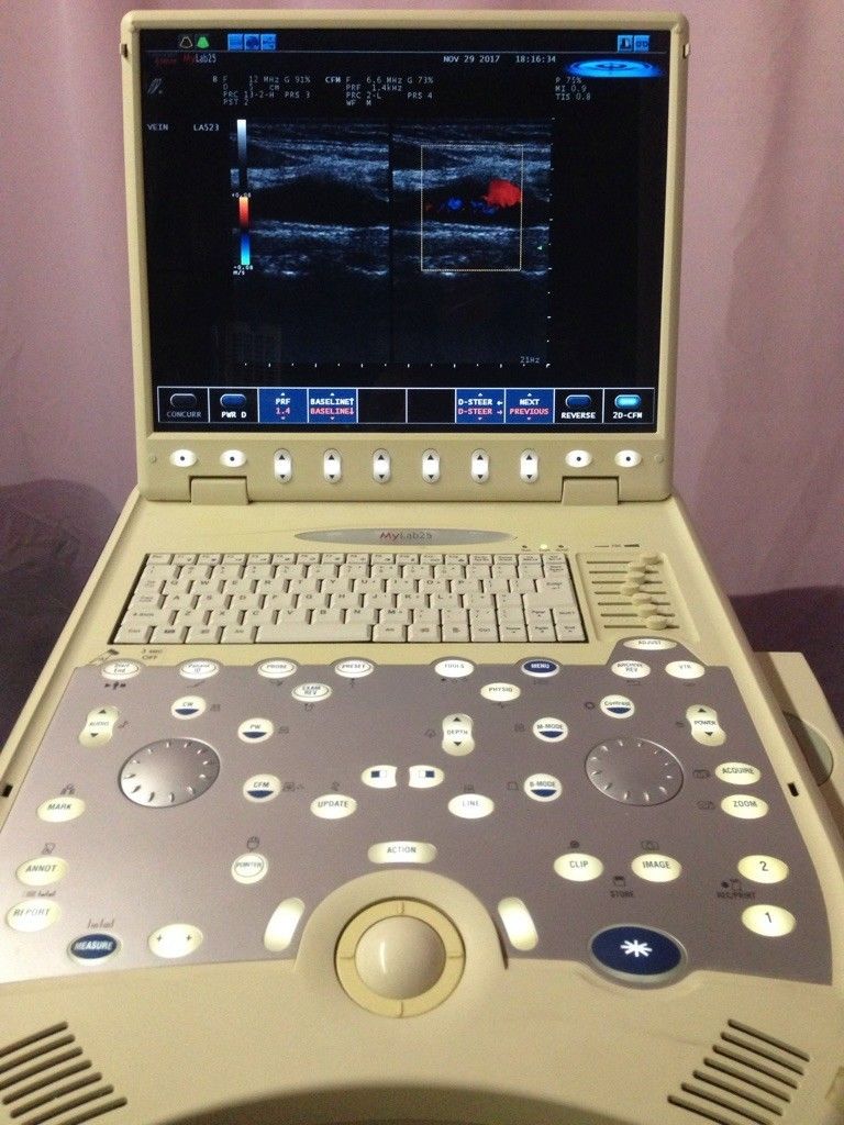 ultrasound machine- 2008 biosound esaote mylab 25 ultrasound, LA 523 probe DIAGNOSTIC ULTRASOUND MACHINES FOR SALE
