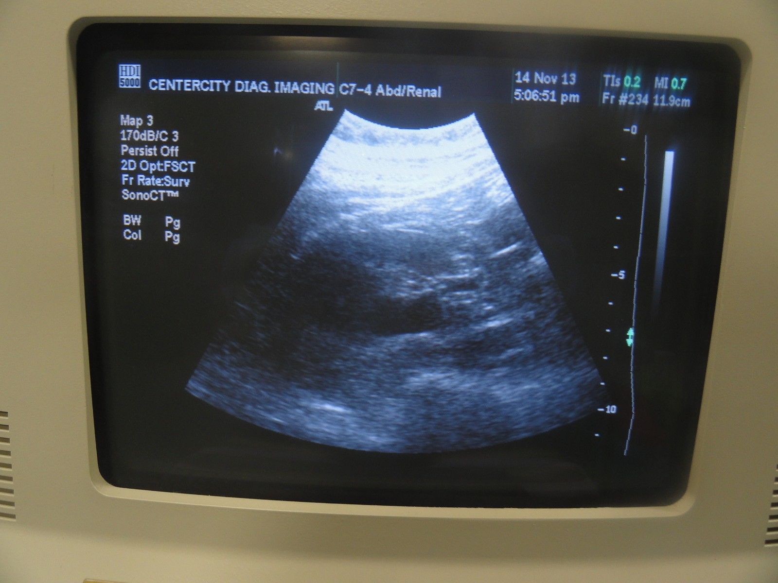 ATL C7-4 40R Curved Array Convex Ultrasound Probe for ATL HDI Series (5966 ) DIAGNOSTIC ULTRASOUND MACHINES FOR SALE