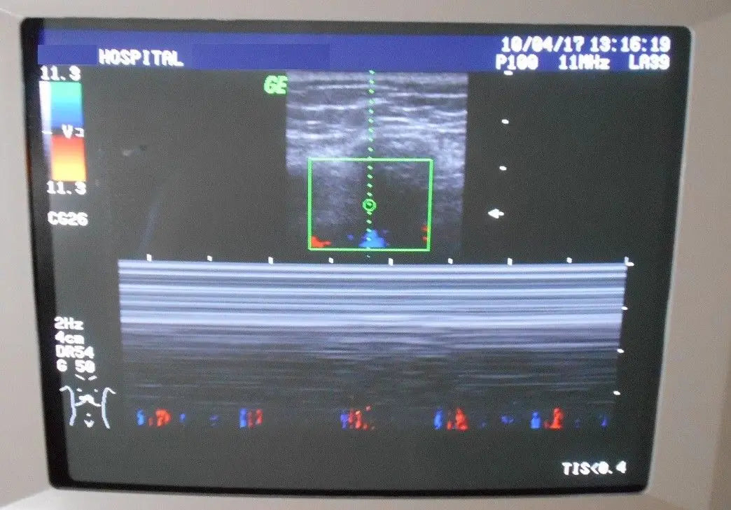 General Electric Logiq 400 2264468 Pro Series Ultrasound w/ Probes E721-C358-LA3 DIAGNOSTIC ULTRASOUND MACHINES FOR SALE