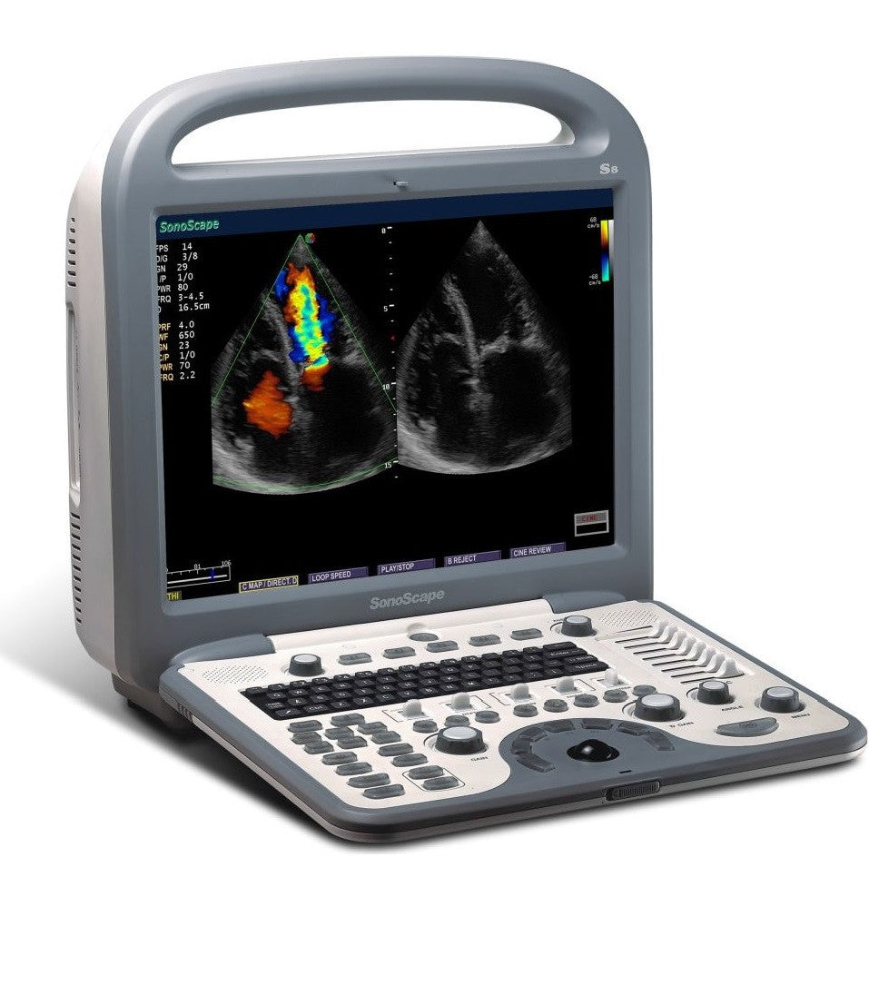 Cardiac DIAGNOSTIC ULTRASOUND MACHINES FOR SALE