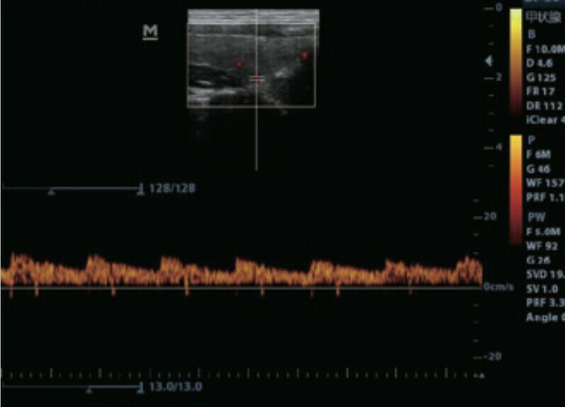 Most Affordable Color Doppler Ultrasound with One Probe LED,THI DIAGNOSTIC ULTRASOUND MACHINES FOR SALE