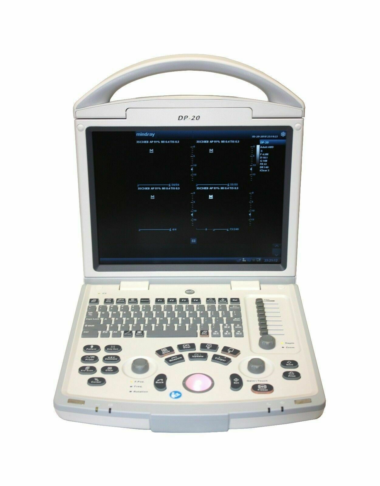 Mindray DP20vet Veterinary Portable Ultrasound with One Choice Probe DIAGNOSTIC ULTRASOUND MACHINES FOR SALE