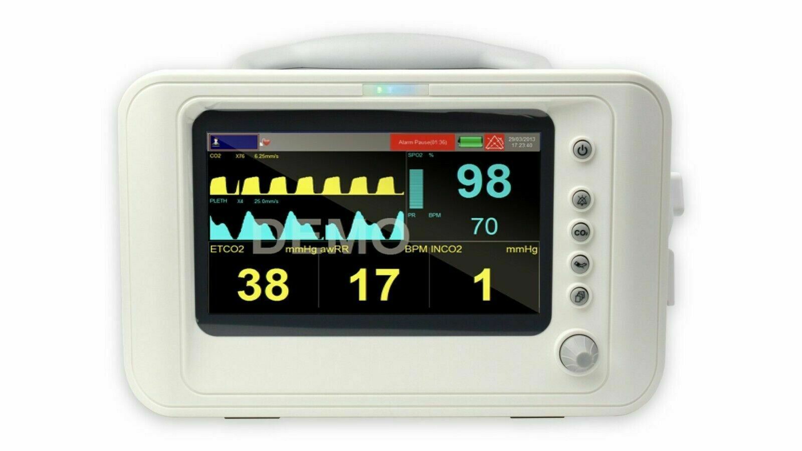 Veterinary Patient Monitor KM-1000C With EtCO2 and SpO2 DIAGNOSTIC ULTRASOUND MACHINES FOR SALE