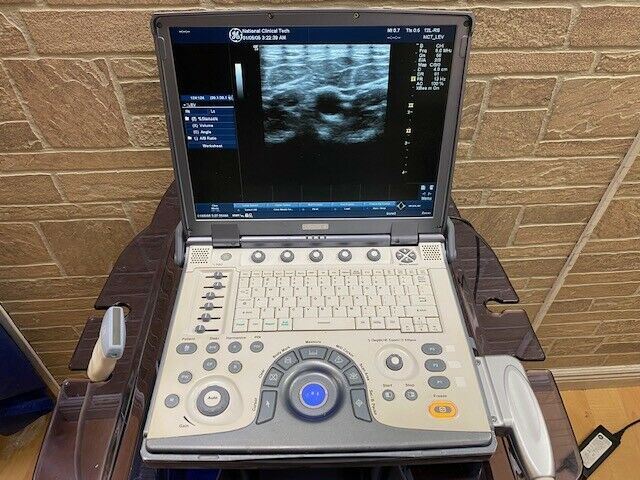 GE LogiQ E portable ultrasound with cardiac phased array probe cart-Warranty DIAGNOSTIC ULTRASOUND MACHINES FOR SALE