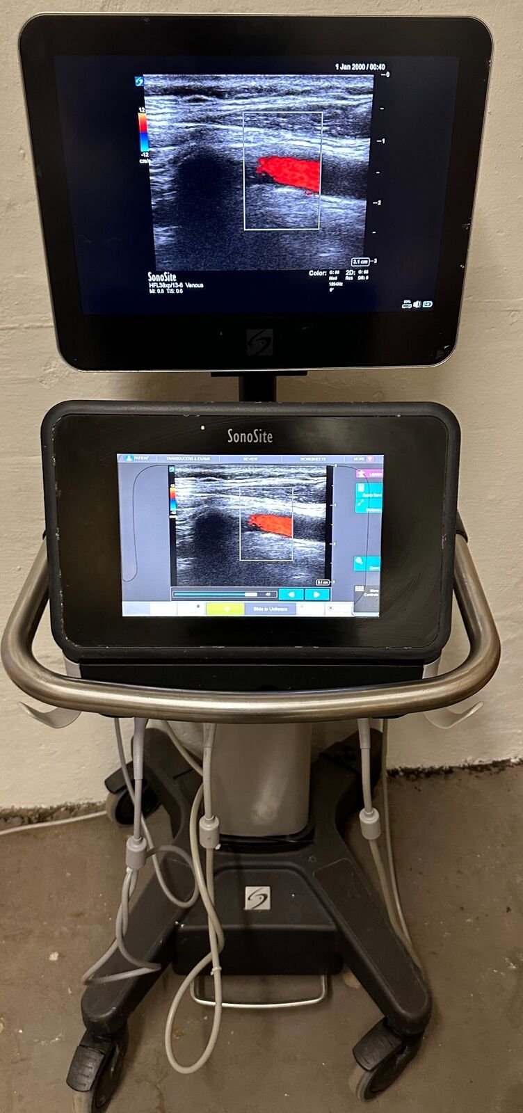 Sonosite X-Porte Ultrasound without probes manufactured 2021 with 3 Probes DIAGNOSTIC ULTRASOUND MACHINES FOR SALE