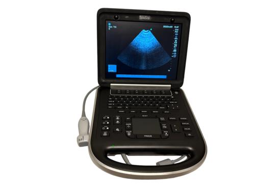 Sonosite Edge Portable Ultrasound 2015 & 3 probes P21x, P25x, C60x Refurbished DIAGNOSTIC ULTRASOUND MACHINES FOR SALE