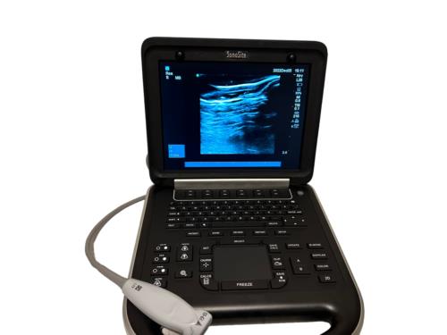 Sonosite Edge Portable Ultrasound 2015 & 3 probes P21x, P25x, C60x Refurbished DIAGNOSTIC ULTRASOUND MACHINES FOR SALE