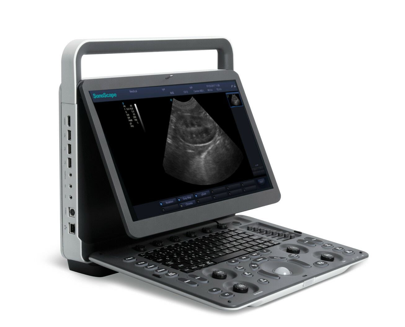 SonoScape A6V Expert (E1V) Veterinary Ultrasound - Rectal probe, Trolley, Bag DIAGNOSTIC ULTRASOUND MACHINES FOR SALE