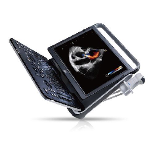 Chison eBit 60 Color Doppler Ultrasound Scanner CW w/ Cardiac and Linear Probes DIAGNOSTIC ULTRASOUND MACHINES FOR SALE