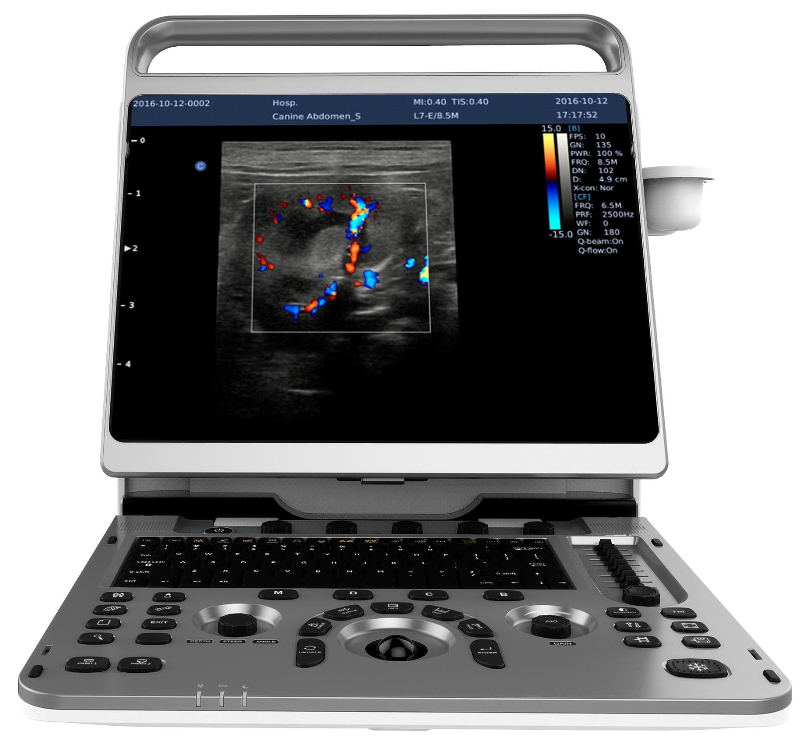 Chison EBit 50, 2D Steer, Super Needle, B/BC, FHI, Battery, Portable, 15" Screen DIAGNOSTIC ULTRASOUND MACHINES FOR SALE