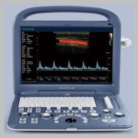 SonoScape S2 with one Linear array  Probe L741  5.0-10.0 Mhz DIAGNOSTIC ULTRASOUND MACHINES FOR SALE