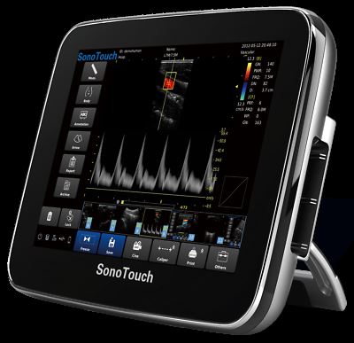 Chison Sonotouch 30 Color Doppler Veterinary Ultrasound Scanner & rectal probe DIAGNOSTIC ULTRASOUND MACHINES FOR SALE