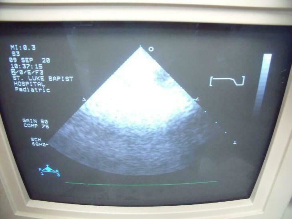 PHILIPS 21311A S3 ULTRASOUND PROBE | PR163 DIAGNOSTIC ULTRASOUND MACHINES FOR SALE