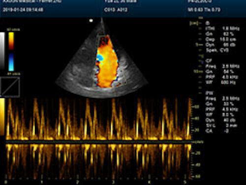 Affordable Large Animal Veterinary Color Doppler Ultrasound & Rectal Probe DIAGNOSTIC ULTRASOUND MACHINES FOR SALE