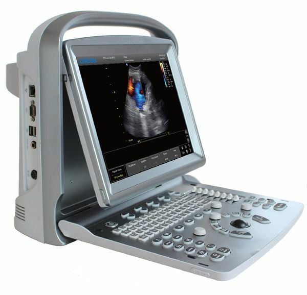 Color Doppler Vascular Ultrasound Scanner with fourProbes, Battery - Chison ECO5 DIAGNOSTIC ULTRASOUND MACHINES FOR SALE