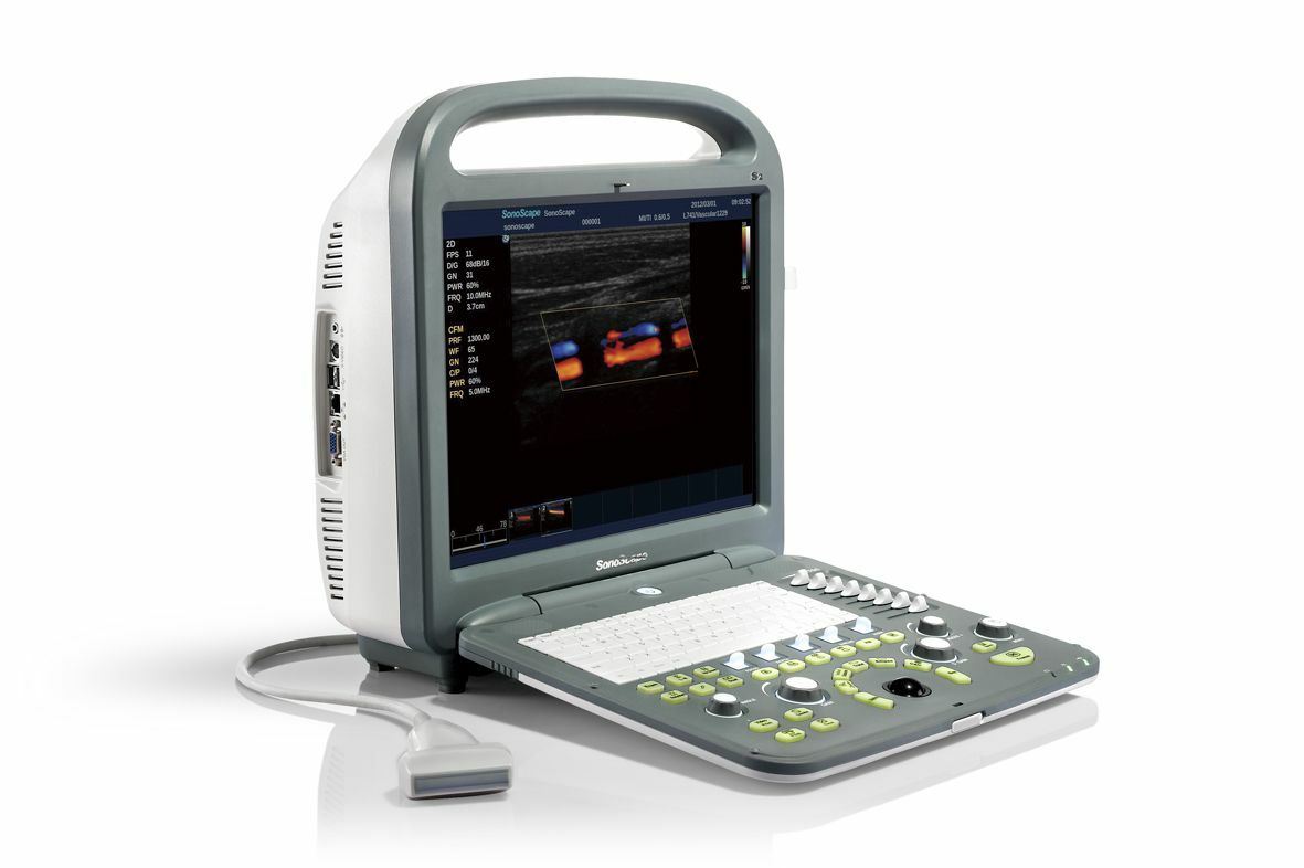 Used SonoScape S2 with Linear Array Probe for MSK, Vascular Excellent Condition DIAGNOSTIC ULTRASOUND MACHINES FOR SALE