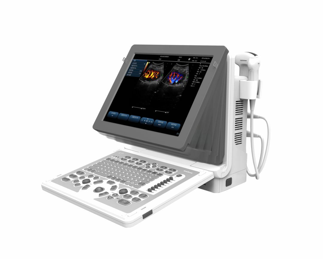 Highest quality Virtual 4D Ultrasound Chison Ebit 30 DIAGNOSTIC ULTRASOUND MACHINES FOR SALE