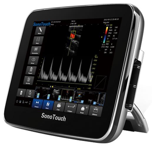 Chison Sonotouch 30 Color Doppler Ultrasound Scanner with Two Probes - Used DIAGNOSTIC ULTRASOUND MACHINES FOR SALE