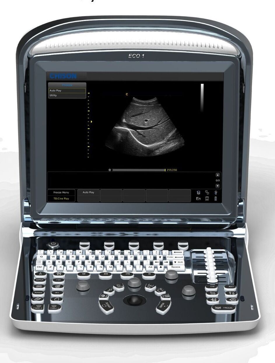 Chison ECO1 Portable LED Ultrasound Scanner, Quality and Affordable DIAGNOSTIC ULTRASOUND MACHINES FOR SALE