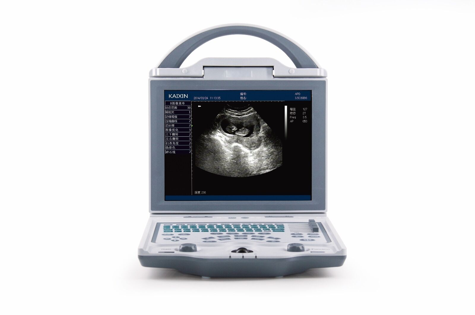 Newest-Light Weight Portable Ultrasound & One Probe, DICOM, LED screen DIAGNOSTIC ULTRASOUND MACHINES FOR SALE