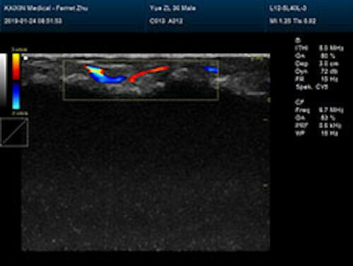 Newest- Farbe Tragbar Ultraschall & Ein Sonde, Dicom , LED Display DIAGNOSTIC ULTRASOUND MACHINES FOR SALE