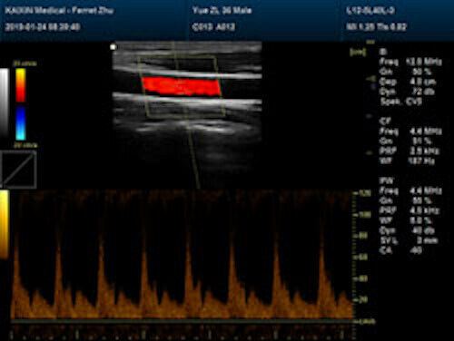 Newest- Farbe Tragbar Ultraschall & Ein Sonde, Dicom , LED Display DIAGNOSTIC ULTRASOUND MACHINES FOR SALE