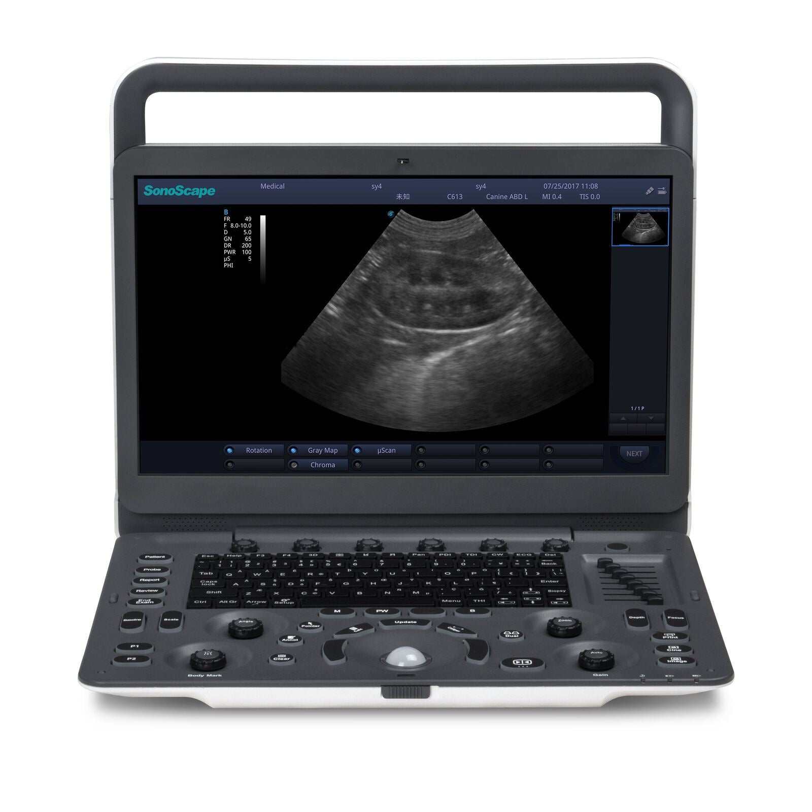 Veterinary Ultrasound Sonoscape A6V Expert (E1V) With Rectal and Micro Convex DIAGNOSTIC ULTRASOUND MACHINES FOR SALE