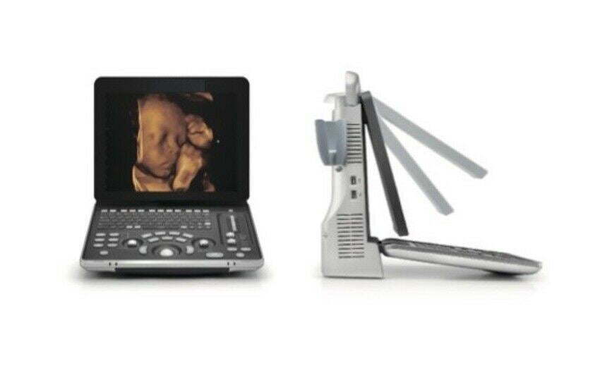 Newest high high quality 4D Portable Ultrasound & One Volumetric probe DIAGNOSTIC ULTRASOUND MACHINES FOR SALE