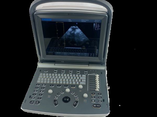 Chison ECO6 Portable  Color doppler Ultrasound with CW and phase array probe P3E DIAGNOSTIC ULTRASOUND MACHINES FOR SALE