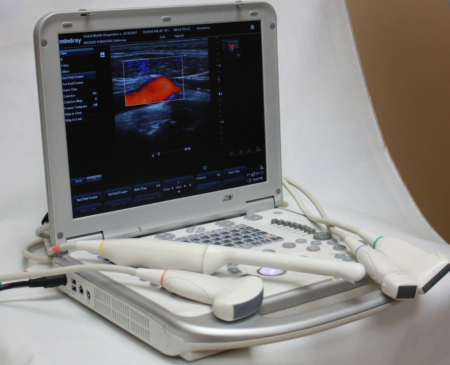 Mindray M7 Color Doppler Ultrasound 2017, 2 Probes, in excellent condition DIAGNOSTIC ULTRASOUND MACHINES FOR SALE