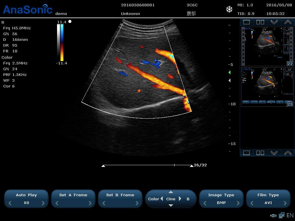 Veterinary Ultrasound Color Doppler, Quality Continuous Wave CW&Two Probes, C7 DIAGNOSTIC ULTRASOUND MACHINES FOR SALE