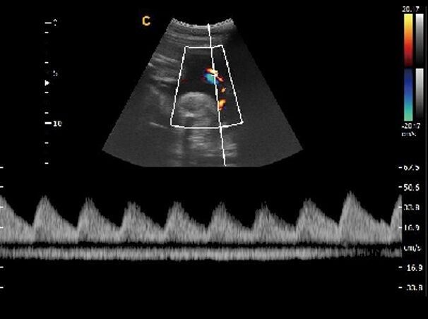 Chison Q9 Color Doppler Ultrasound Scanner With Two Probes Cardiac and Vascular DIAGNOSTIC ULTRASOUND MACHINES FOR SALE