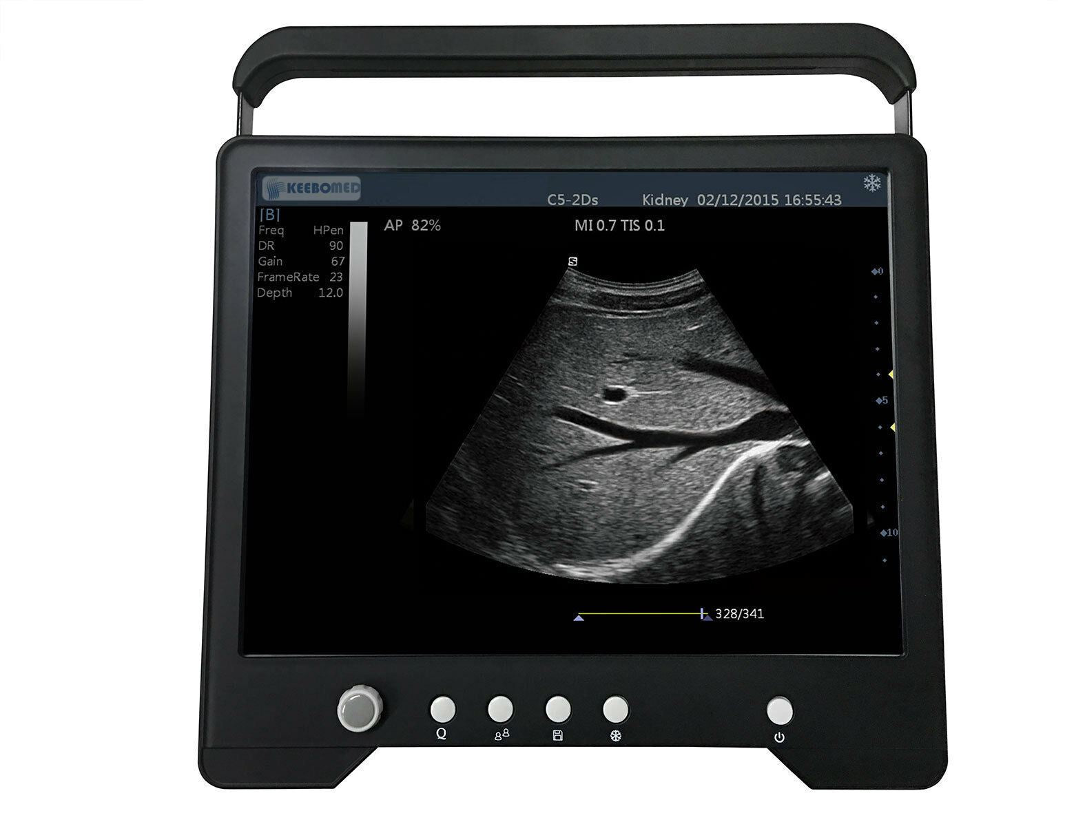 Veterinary Touch Screen Ultrasound with Rectal Probe for Large Animals, KeeboMed DIAGNOSTIC ULTRASOUND MACHINES FOR SALE