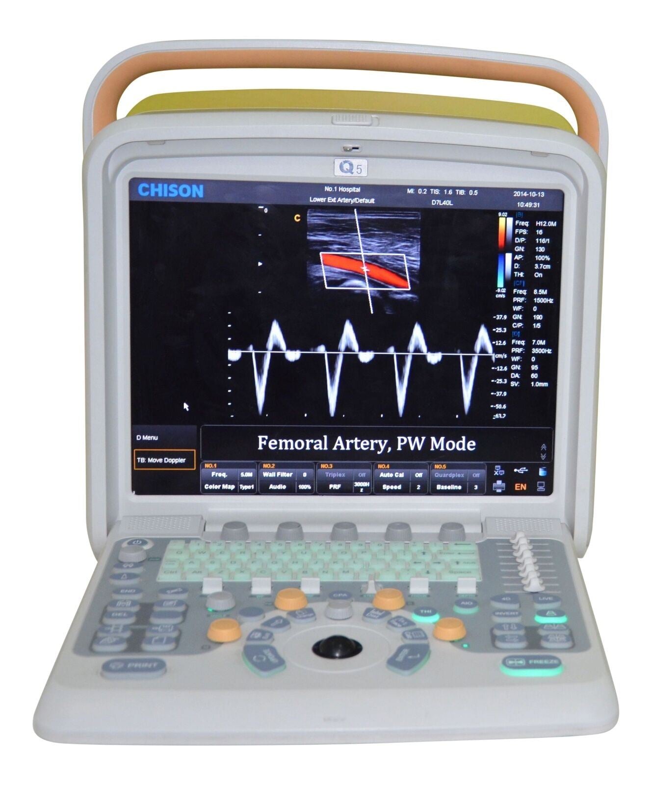 Veterinary Ultrasound Scanner with 2 Probes - Color Doppler Chison Q5Vet DIAGNOSTIC ULTRASOUND MACHINES FOR SALE