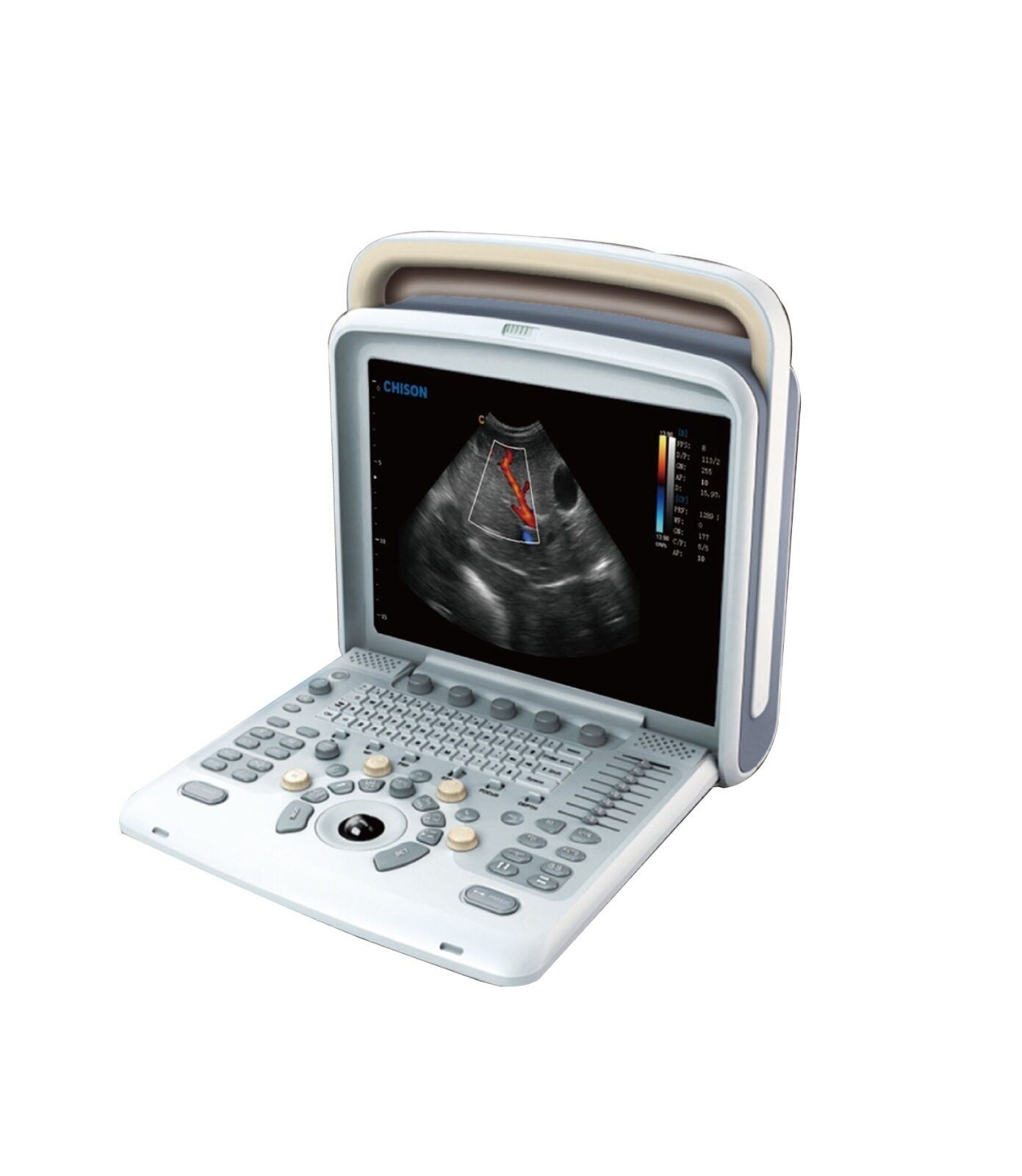 Veterinary Ultrasound Scanner with 2 Probes - Color Doppler Chison Q5Vet DIAGNOSTIC ULTRASOUND MACHINES FOR SALE