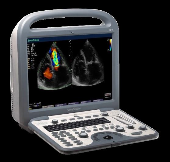 SonoScape S8 with L743 Linear array  Probe Included - new DIAGNOSTIC ULTRASOUND MACHINES FOR SALE