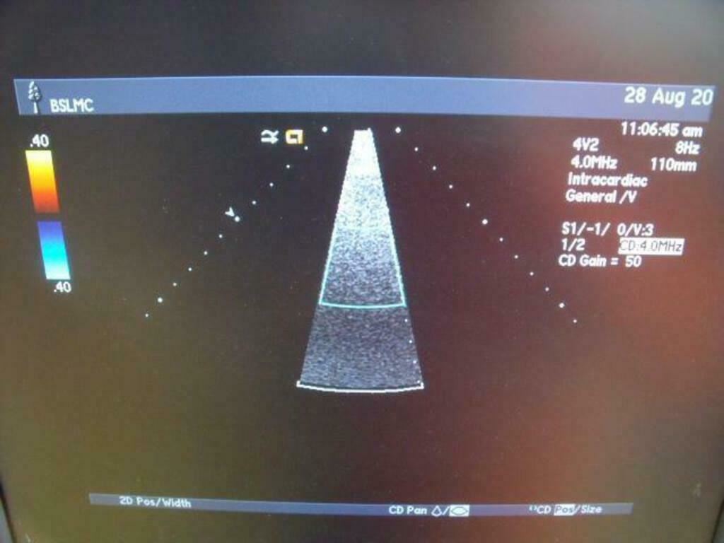 ACUSON 47446-93742503 4V2 ULTRASOUND PROBE | PR5320 DIAGNOSTIC ULTRASOUND MACHINES FOR SALE