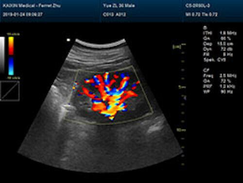 Newest- Color Portable Ultrasound & One Probe, DICOM, LED screen DIAGNOSTIC ULTRASOUND MACHINES FOR SALE