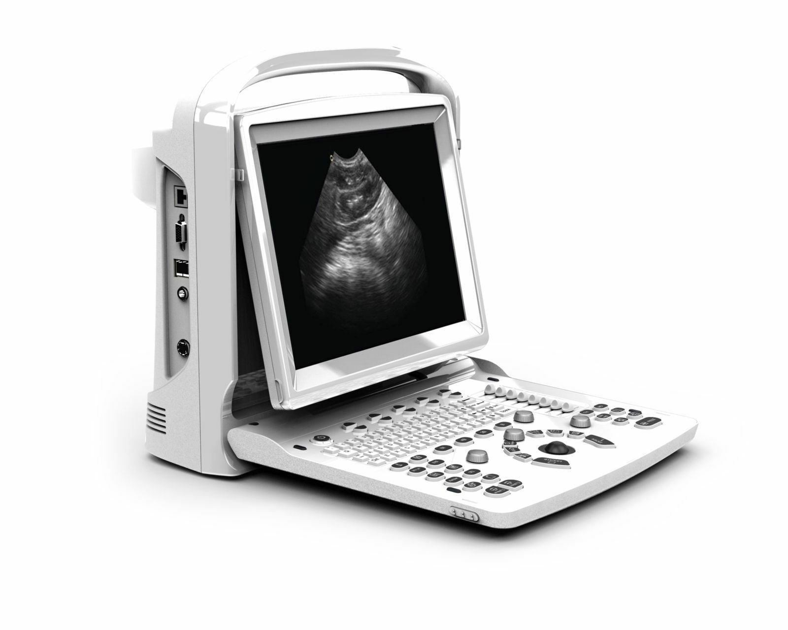 Chison ECO3 Vet Veterinary Ultrasound with one probe DIAGNOSTIC ULTRASOUND MACHINES FOR SALE