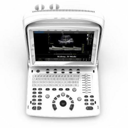 Chison ECO3 Vet Veterinary Ultrasound with one probe DIAGNOSTIC ULTRASOUND MACHINES FOR SALE