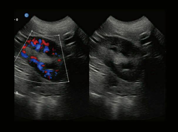 Chison eBit60Vet High End Color Doppler Veterinary Software Portable Ultrasound DIAGNOSTIC ULTRASOUND MACHINES FOR SALE