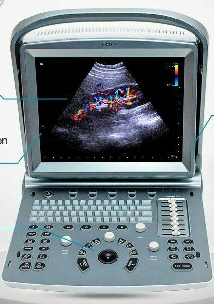 Best Selling Color Doppler Portable Ultrasound Chison ECO5Vet with One Probe DIAGNOSTIC ULTRASOUND MACHINES FOR SALE