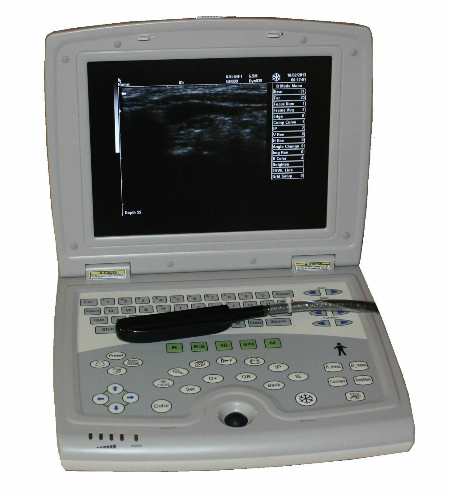 KX5000V Veterinary Laptop Bovine Equine Ultrasound & Rectal Probe, Insertion Arm DIAGNOSTIC ULTRASOUND MACHINES FOR SALE