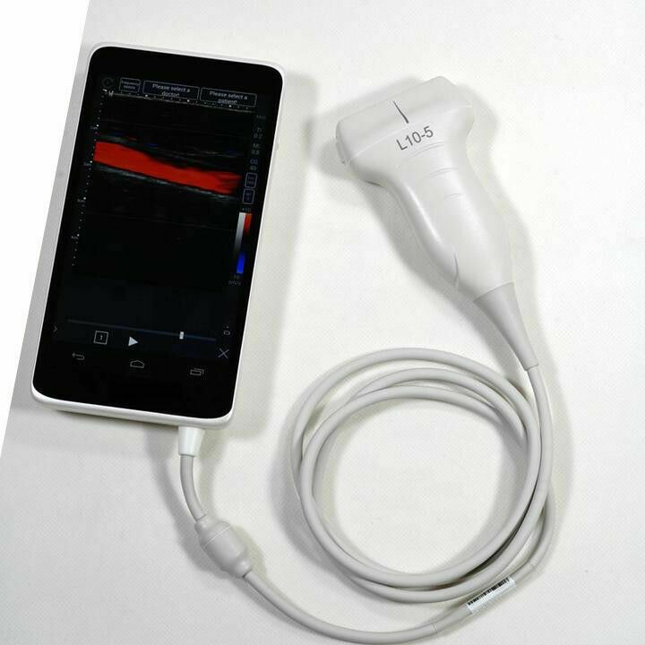 Pocket Size Color Doppler Smart Phone 6" Screen, and Linear Array Probe 5-10MHz DIAGNOSTIC ULTRASOUND MACHINES FOR SALE